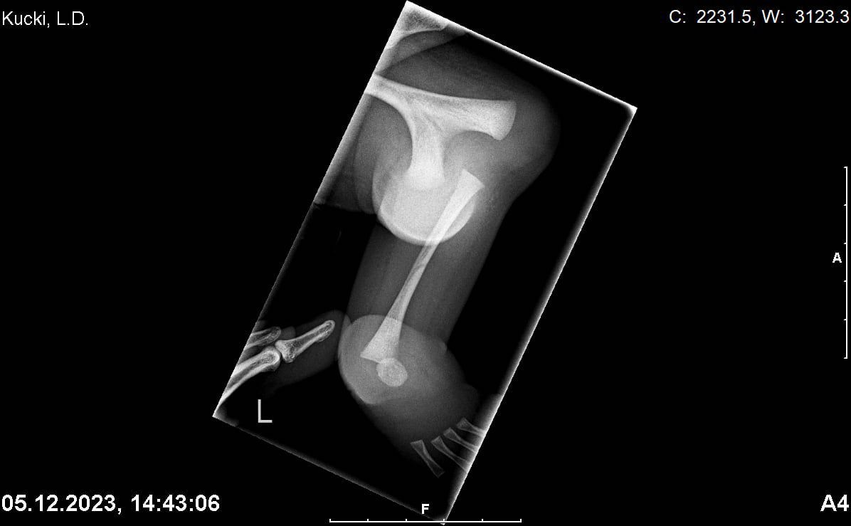 Zdjęcie rentgenowskie