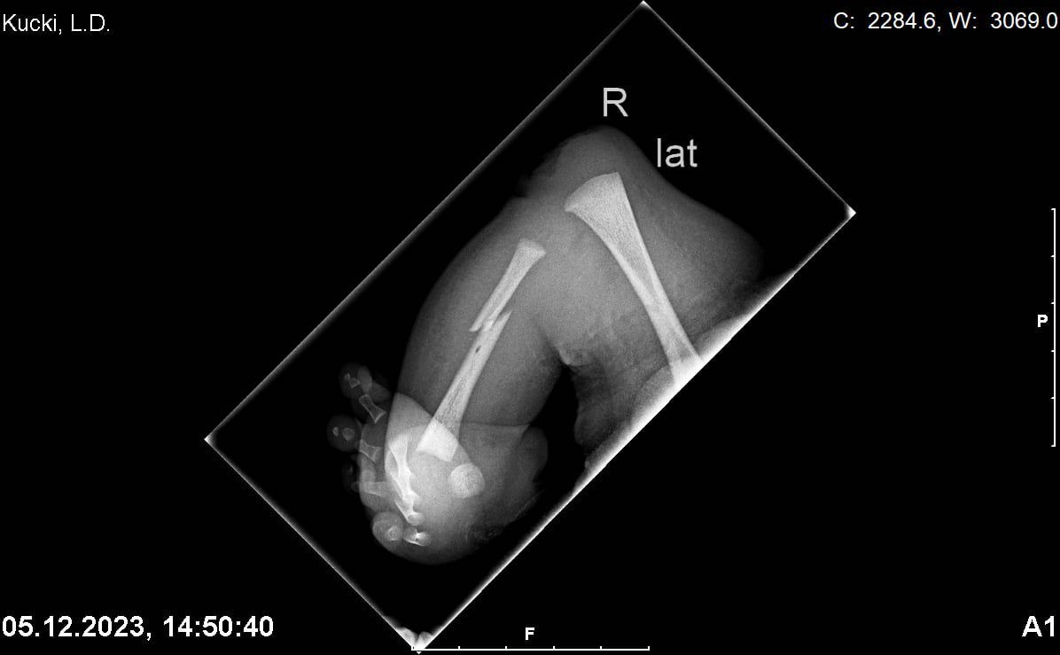 Zdjęcie rentgenowskie